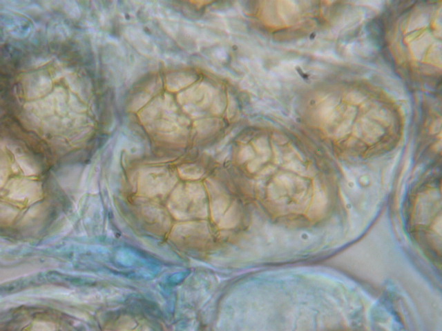 Tuber aestivum ... SPORE
